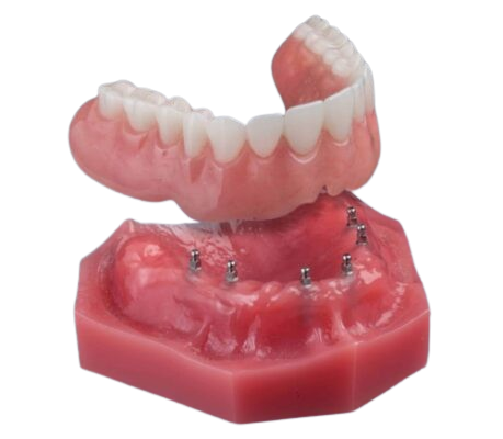 Mini Implant Dentures in Austin, TX | Book a Free Consultation